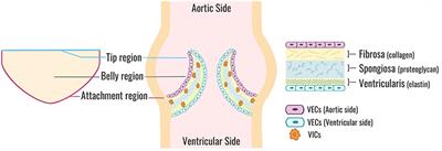 Molecular and Mechanical Mechanisms of Calcification Pathology Induced by Bicuspid Aortic Valve Abnormalities